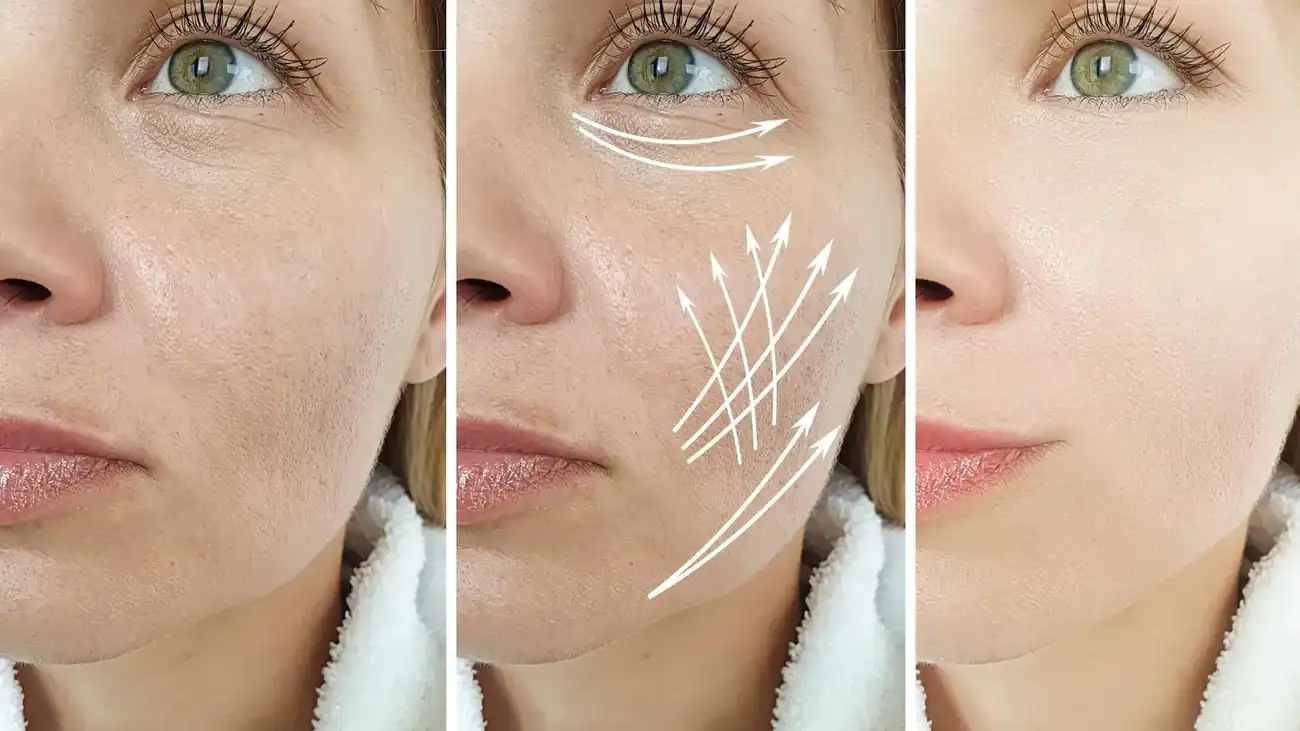 Can One Treatment Really Tackle More Than One Skin Concern Sunbury?