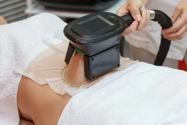 Image of person having fat freezing treatment to help weight gain Sunbury