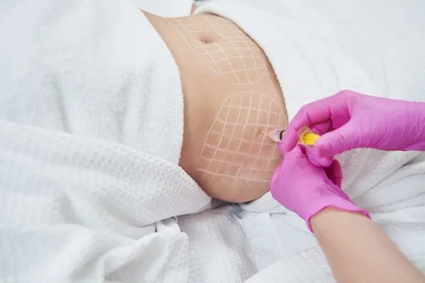 image of fat dissolving injections on love handles to help combat weight gain Sunbury