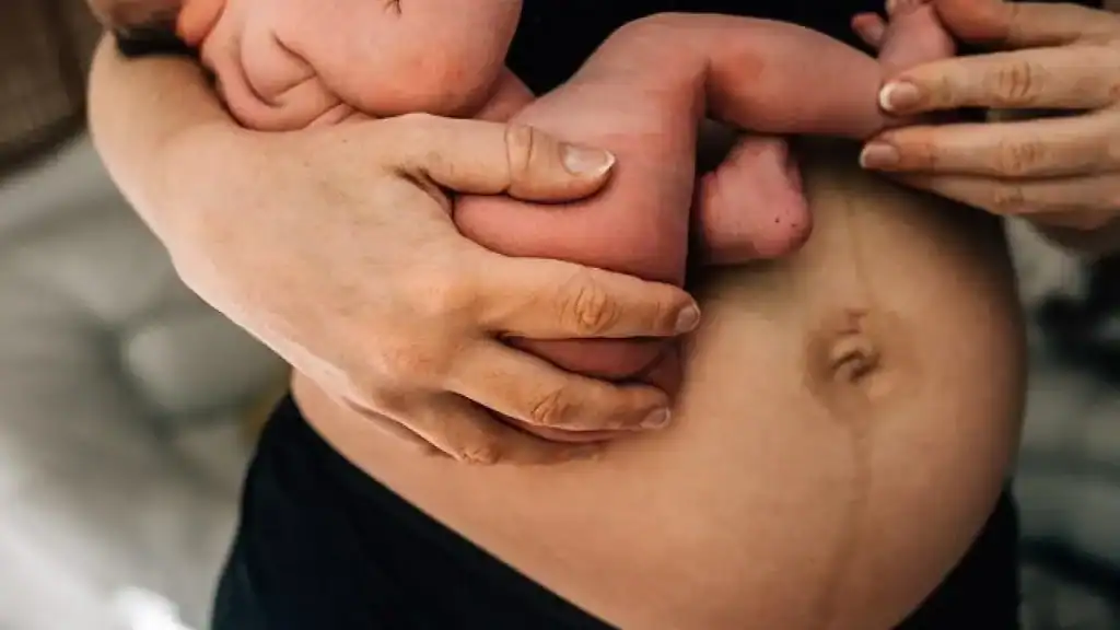 Why Is My Stomach Still Big After Pregnancy Sunbury?